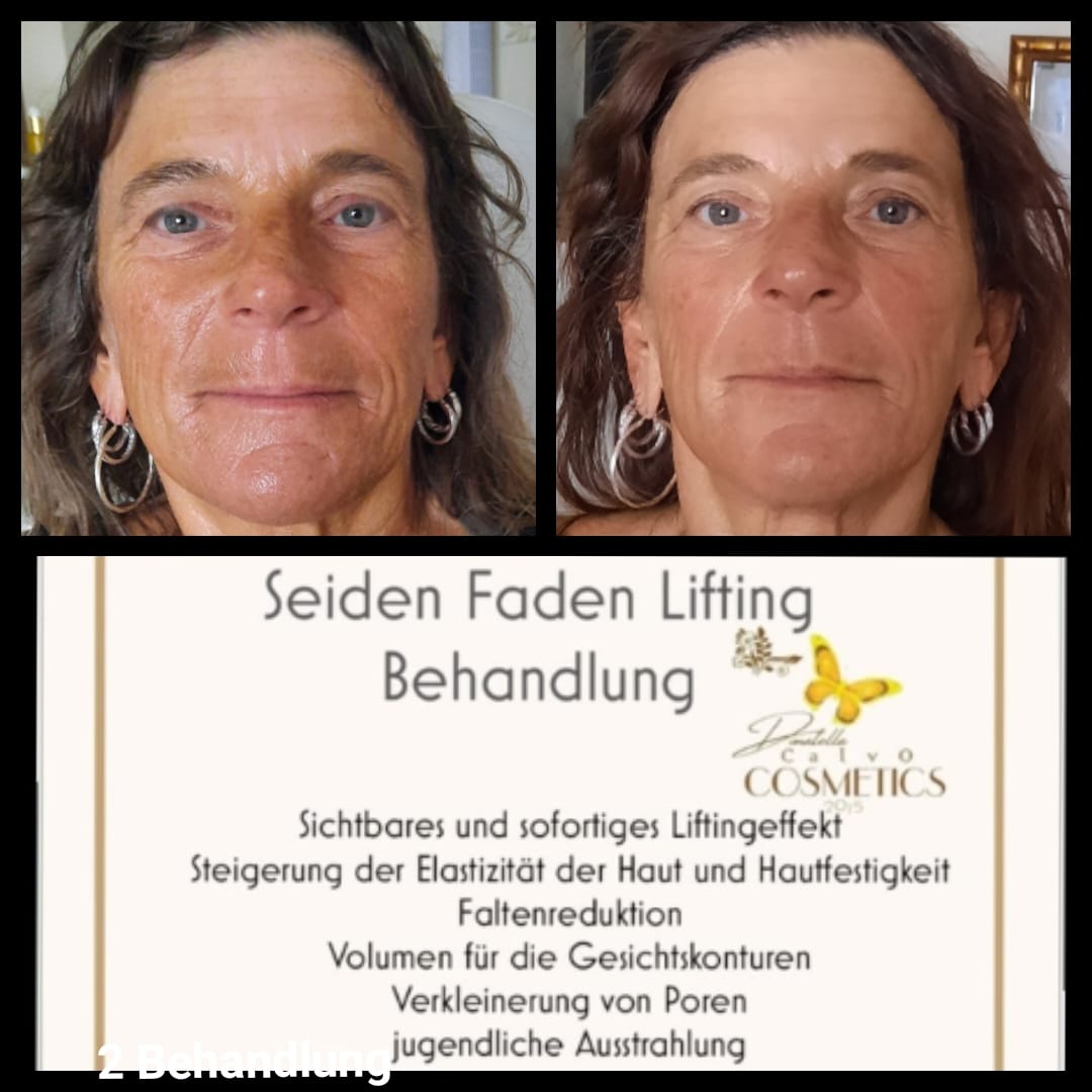 Seidenfaden Lifting Großhandel Starter Set  Schulung für Kosmetik Institute inkl.Starterset &  Anwendungs Video