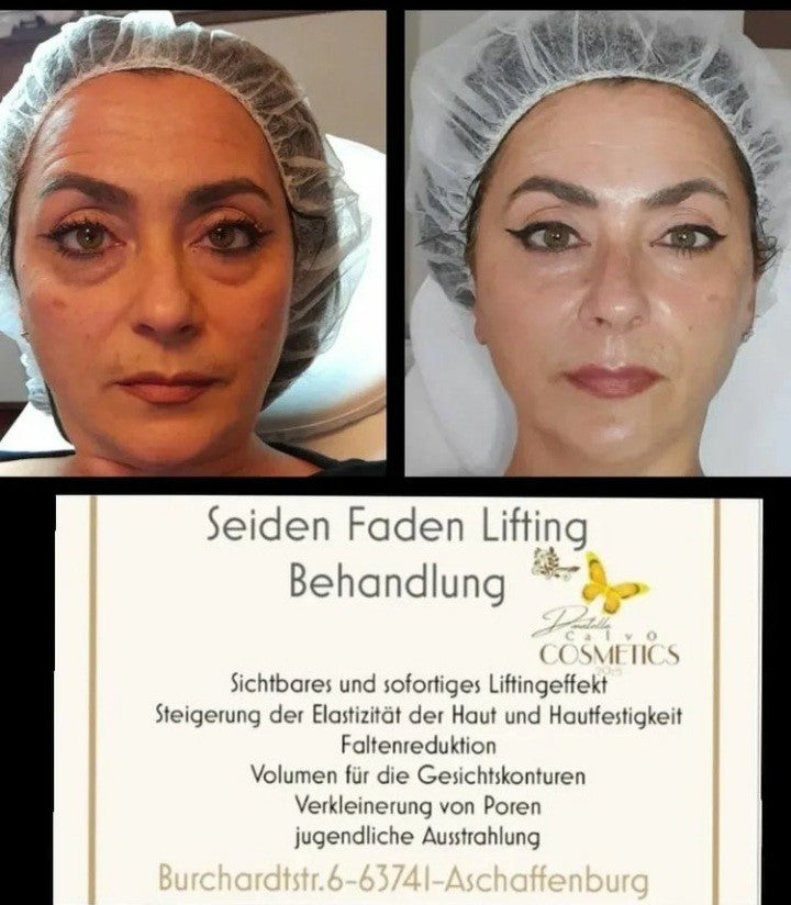 Seidenfaden Lifting Schulung & Starterset für 8-10 Behandlungen inkl. Zertifikat für Kosmetik Institute oder Schulen mit Anleitungs Video